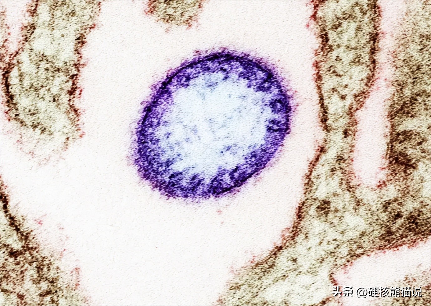 疫情_尼帕病毒印度疫情_尼帕病毒传播途径